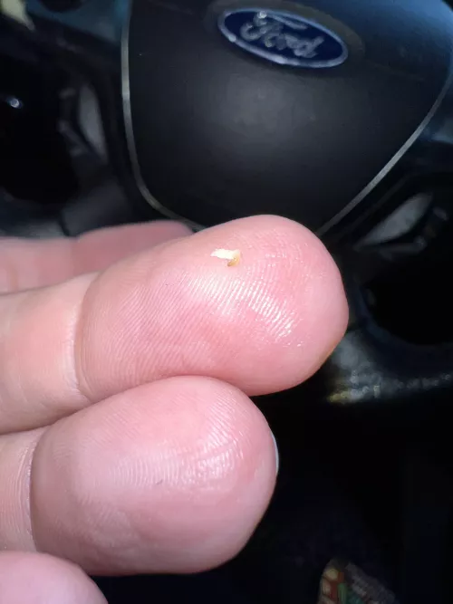 Just popped this from the corner of my mouth!