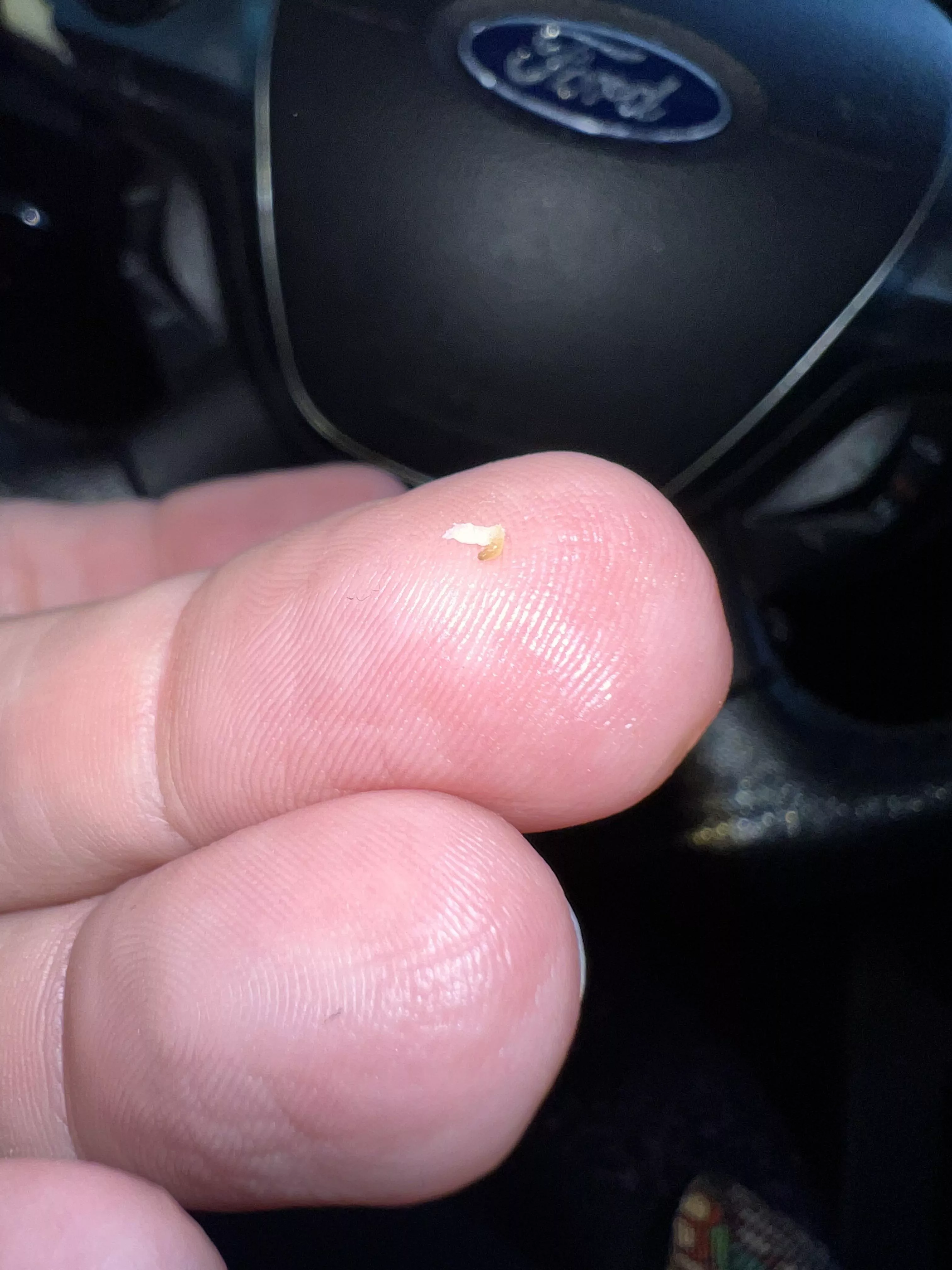 Just popped this from the corner of my mouth!