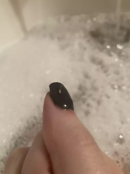 Pulled this bad boy from the back of my leg