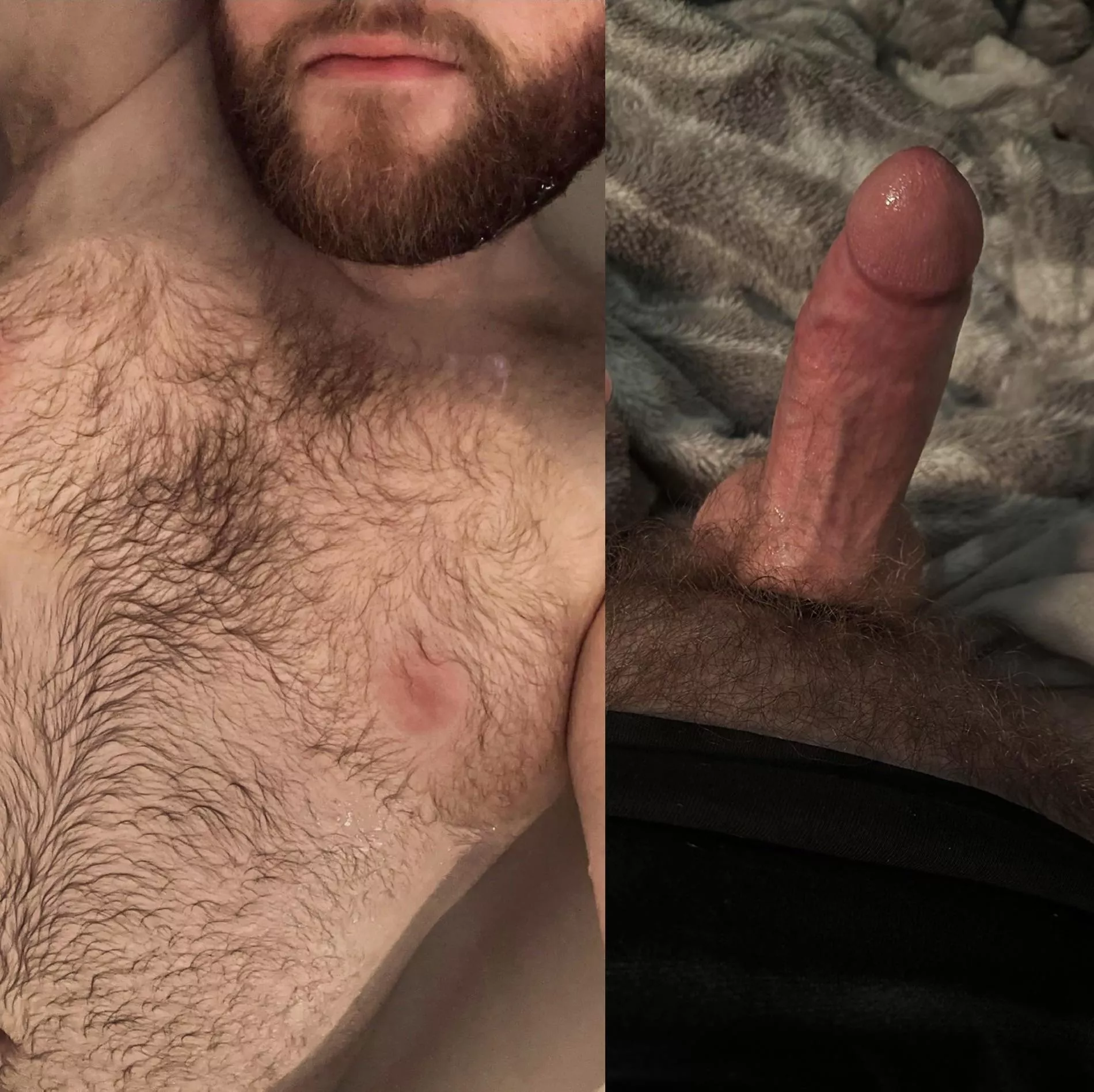 Hairy all over