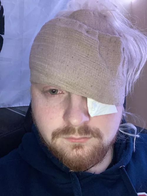 Hoping you fine folks can finally let me know if I’m crazy or not (picture not related, but is from when I had a massive stye (spelling?) and couldn’t find a great way to keep a compress on it and still have use of both hands, and hopefully will be e