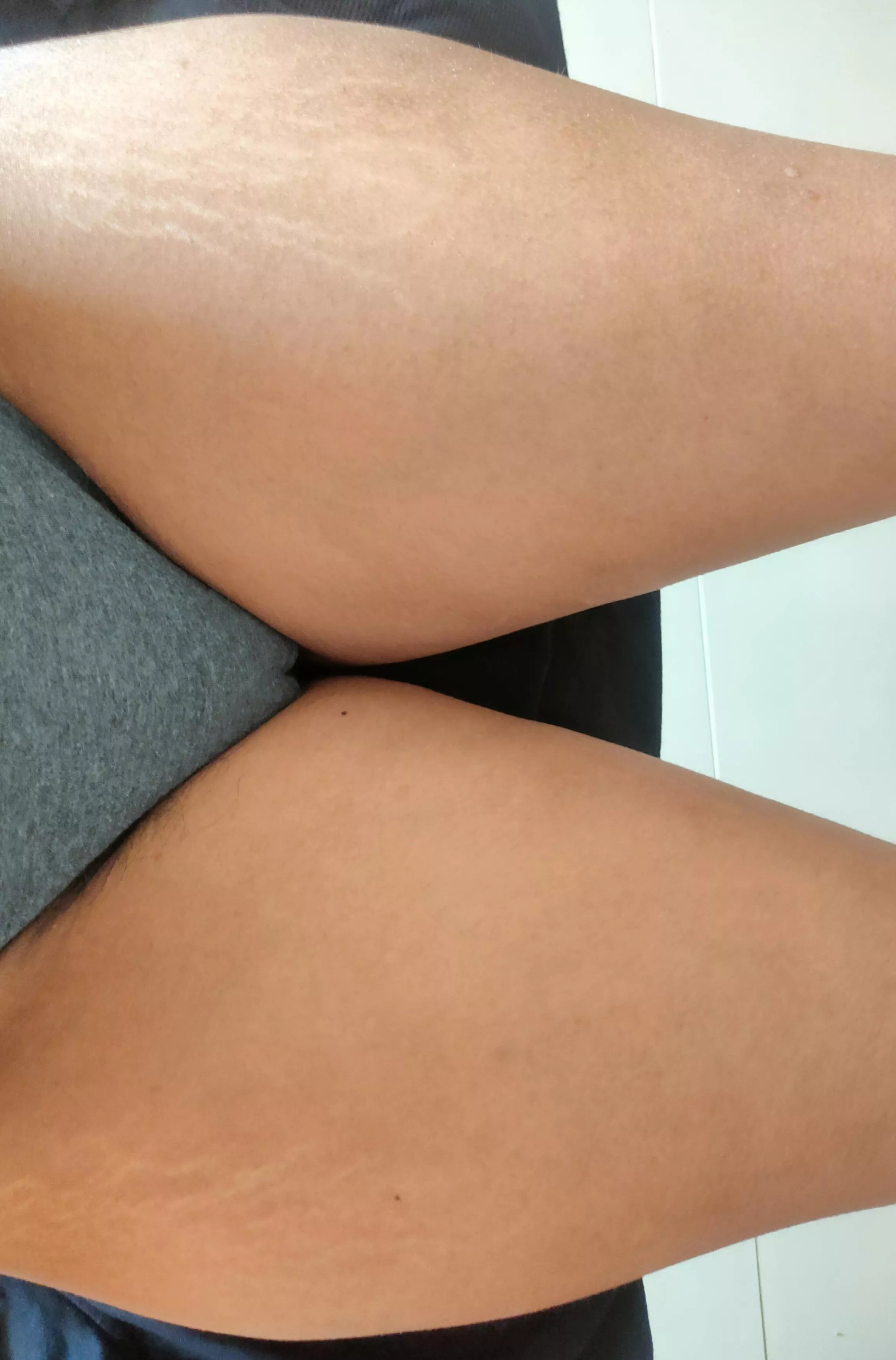 These can choke you to death:))[f]