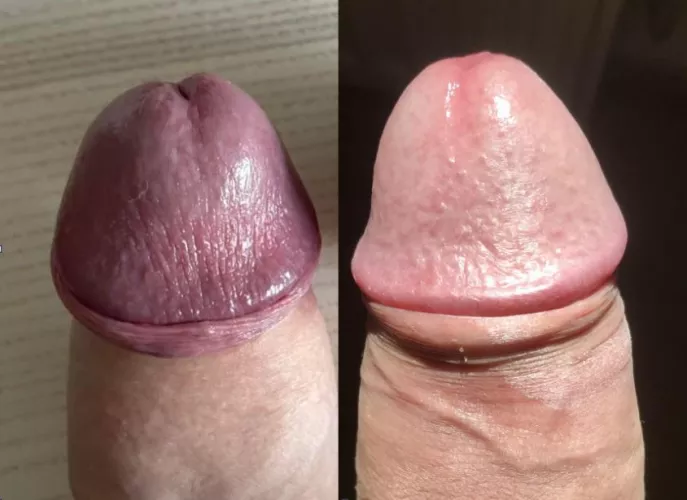 u/BuckoHandz (L) vs me (R)