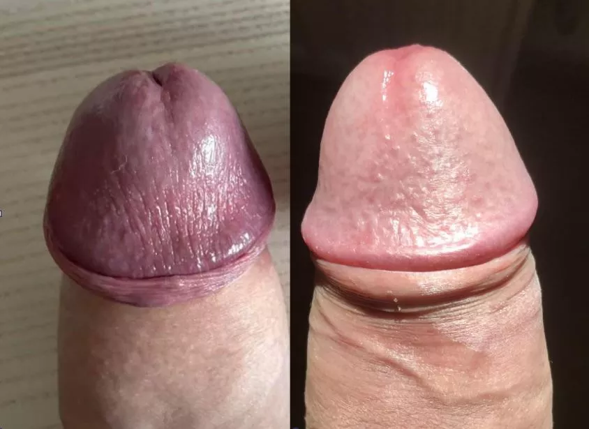 u/BuckoHandz (L) vs me (R)