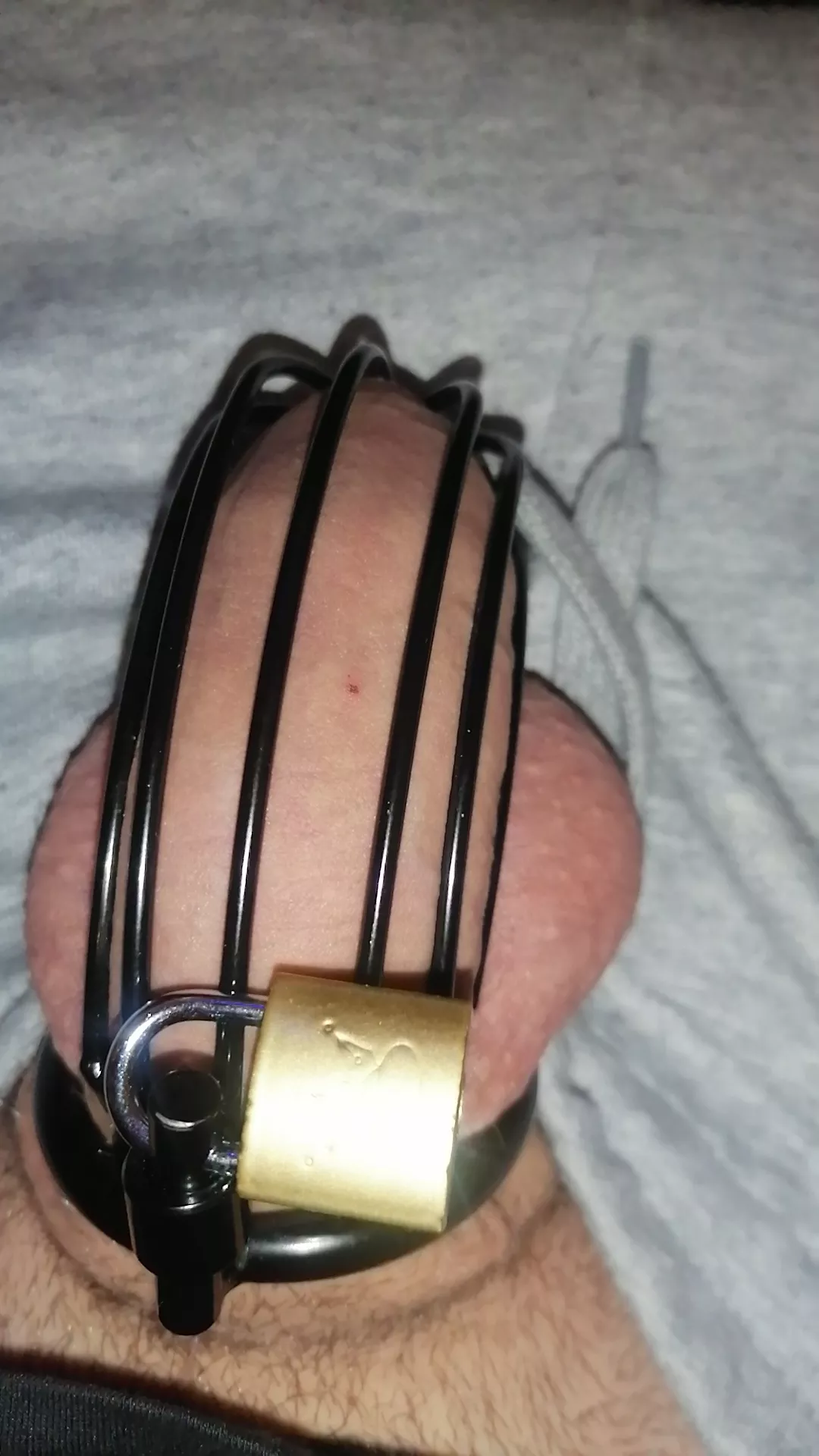 20yo Virgin Boy needs Advice