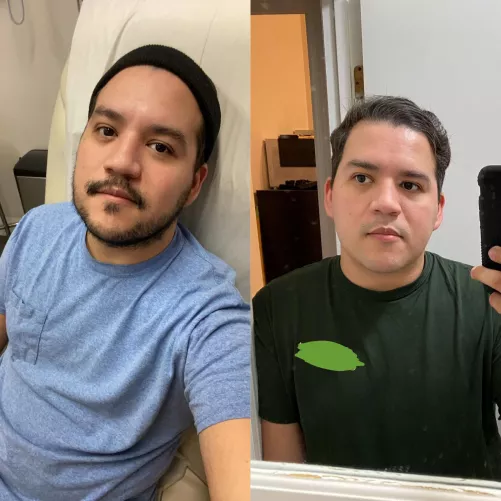 Been dealing with health issues and decided to shave. Needed a pick-me-up. What’s better: unshaven or shaved?