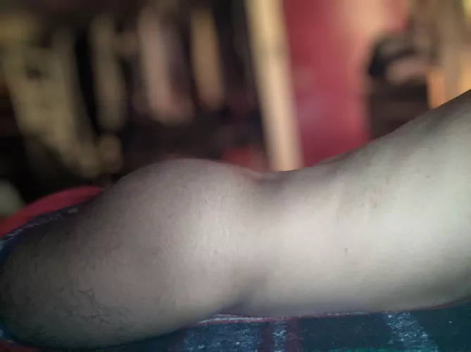 I could use a slap [25]