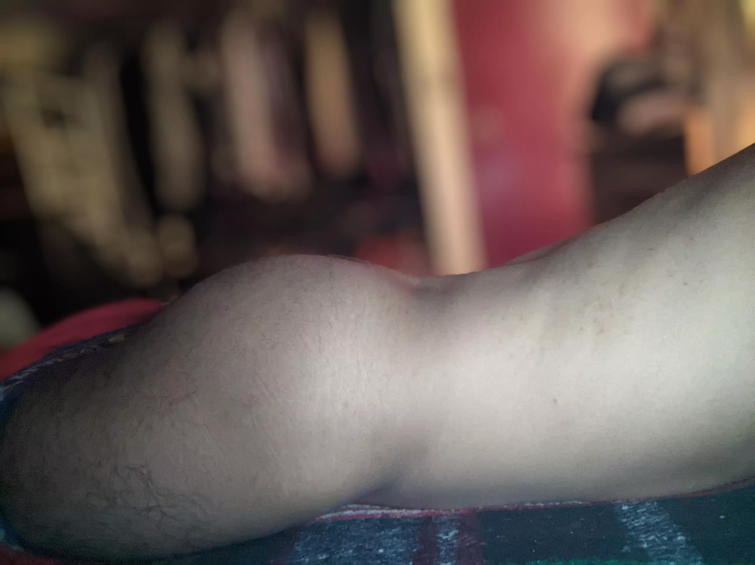 I could use a slap [25]