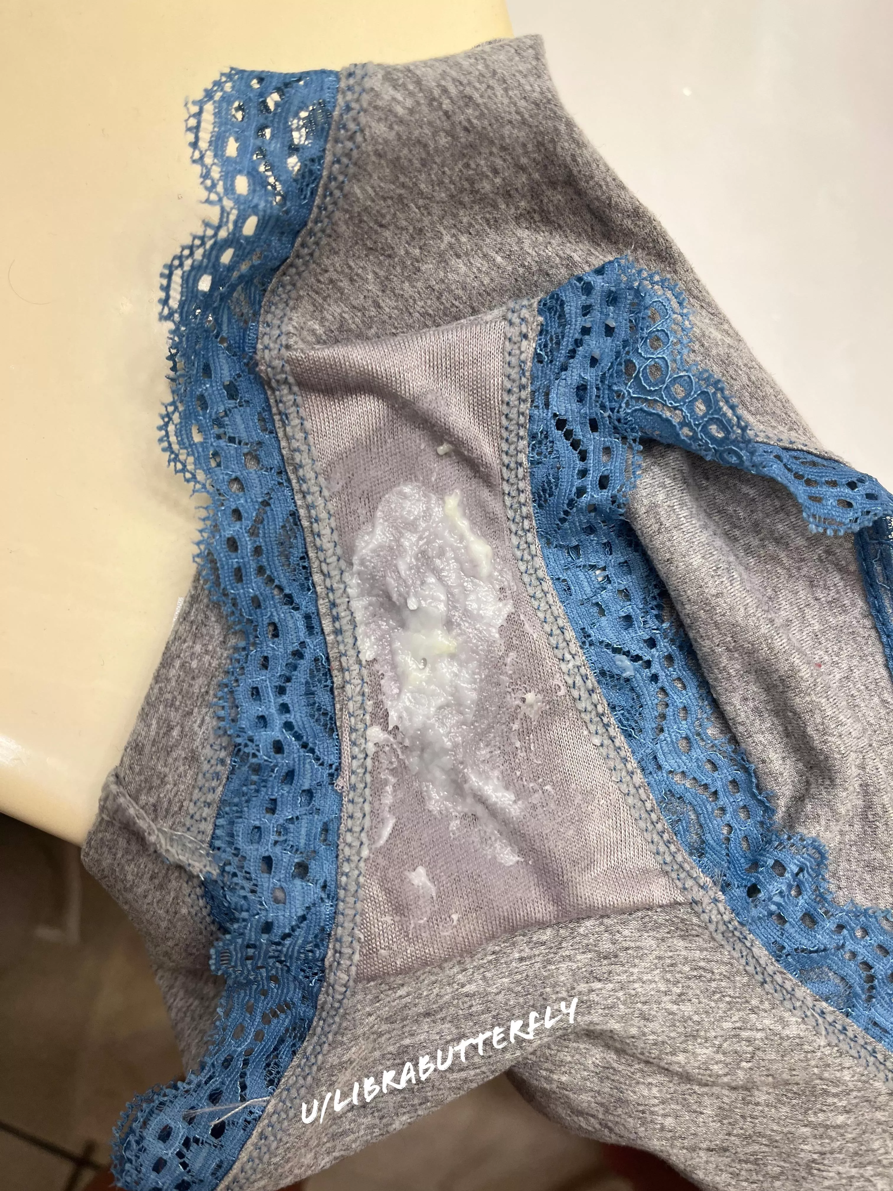 Ovulation at its finest ✨