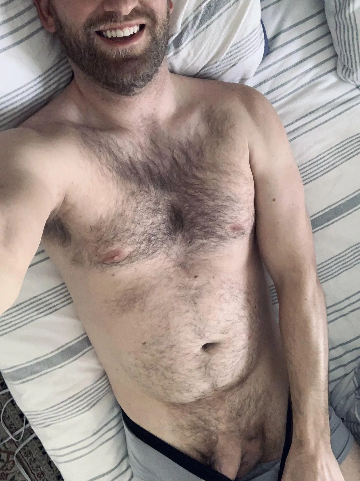 Wanna remove these entirely?