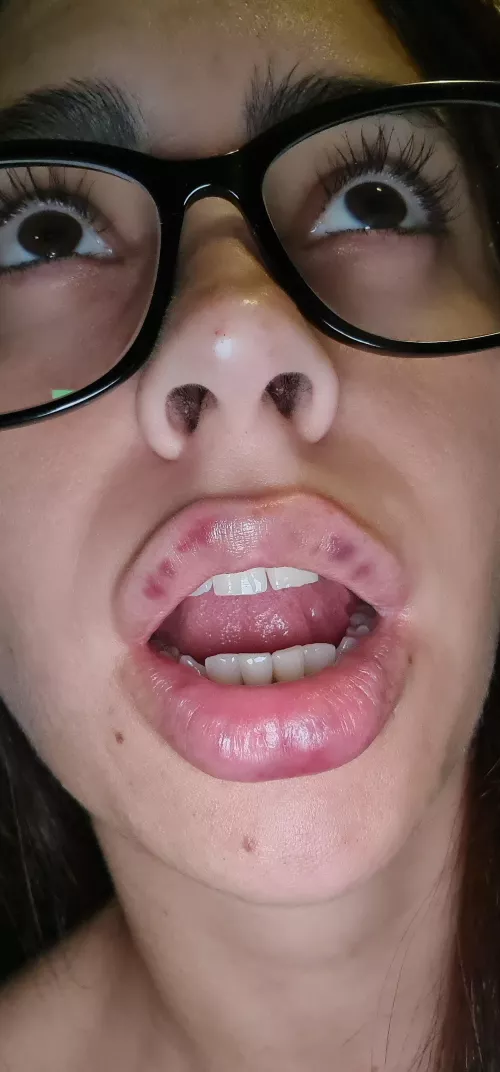 What happened there? 🥺