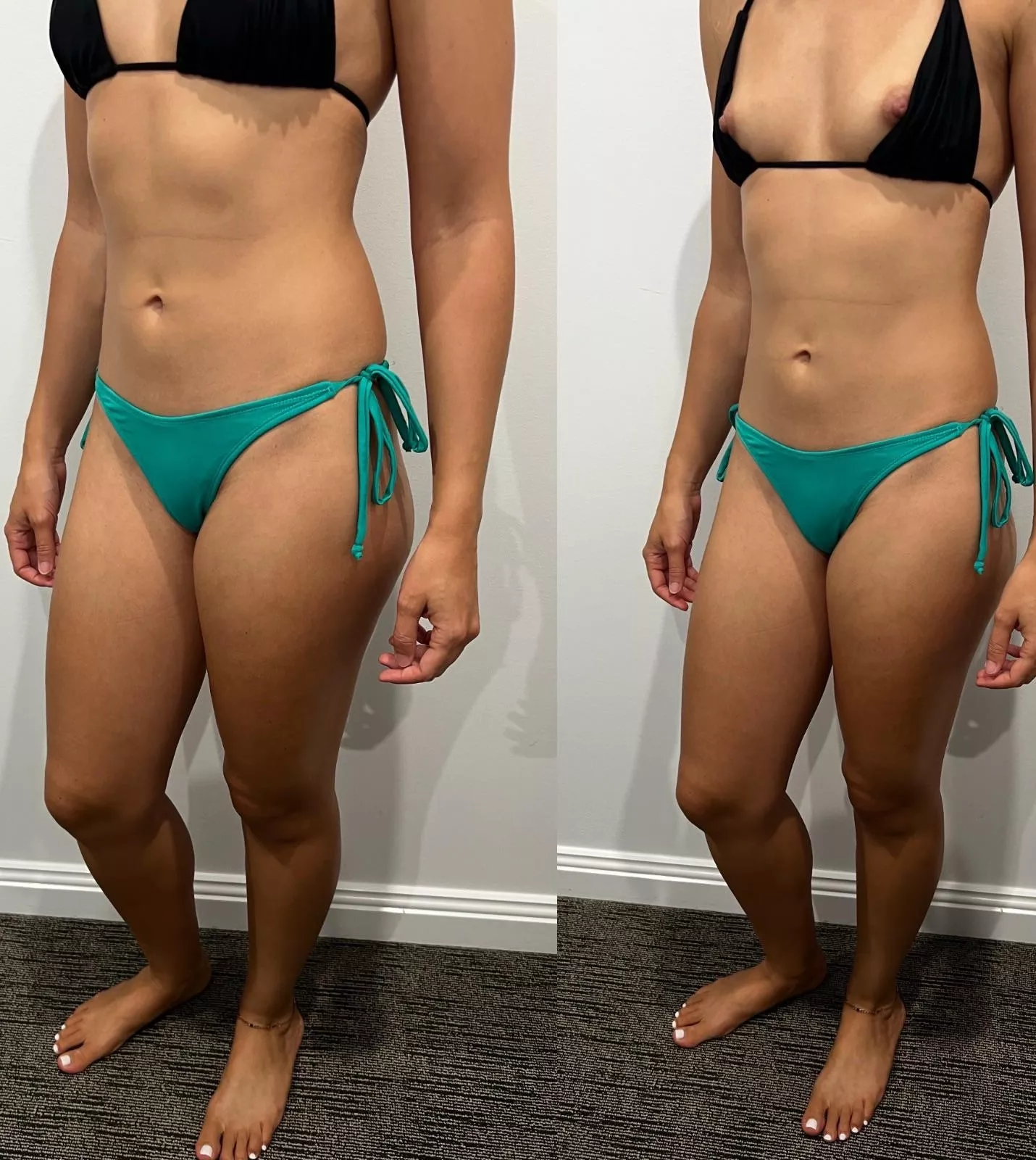 What they see at the beach vs your girl on the internet