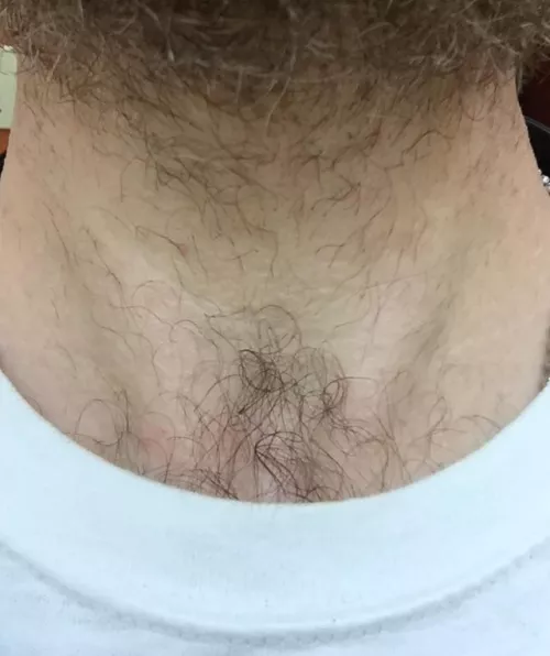 My chest hair wants to grow into my beard