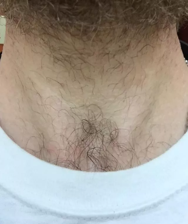 My chest hair wants to grow into my beard