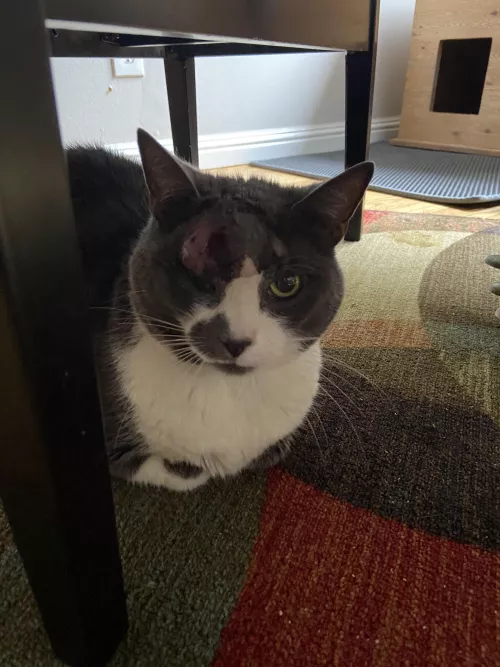 Poor JJ found out he had diabetes and had to have a huge abscess on his eyebrow lanced