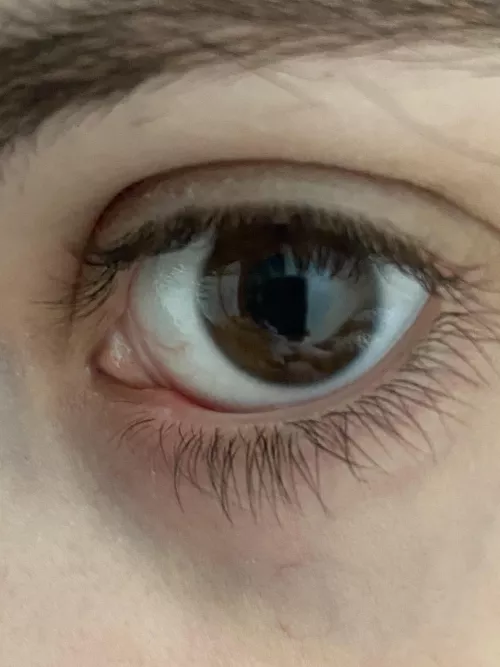 Second internal stye within a month...