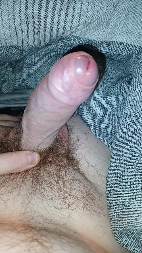 Who wants to pull this foreskin back 👀