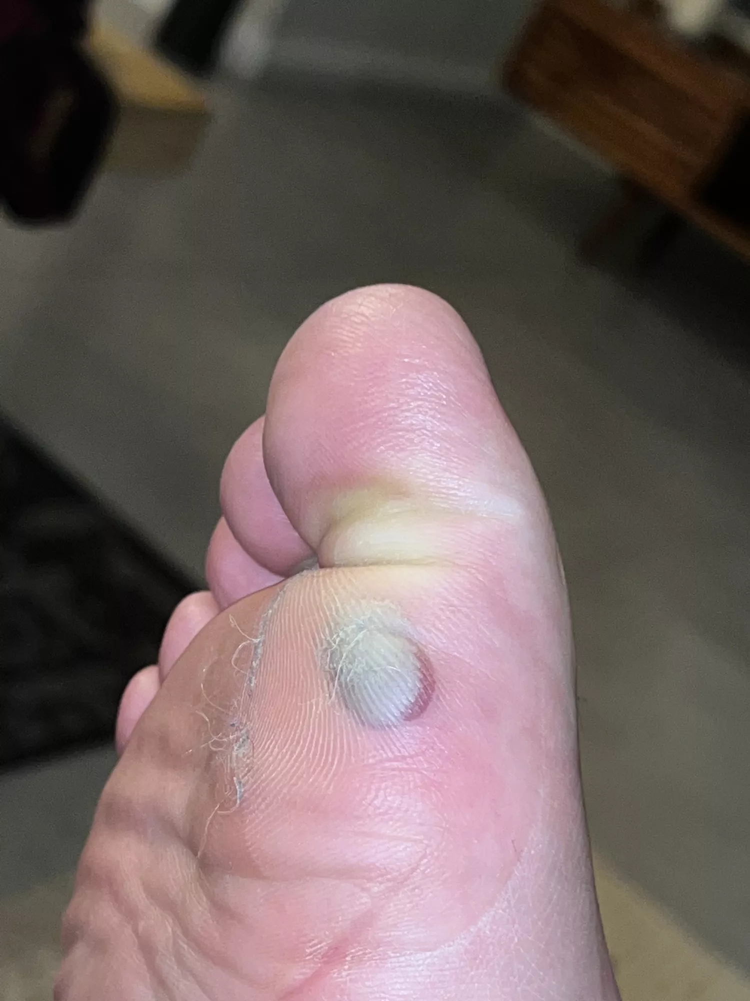 The urge to pop it is overwhelming