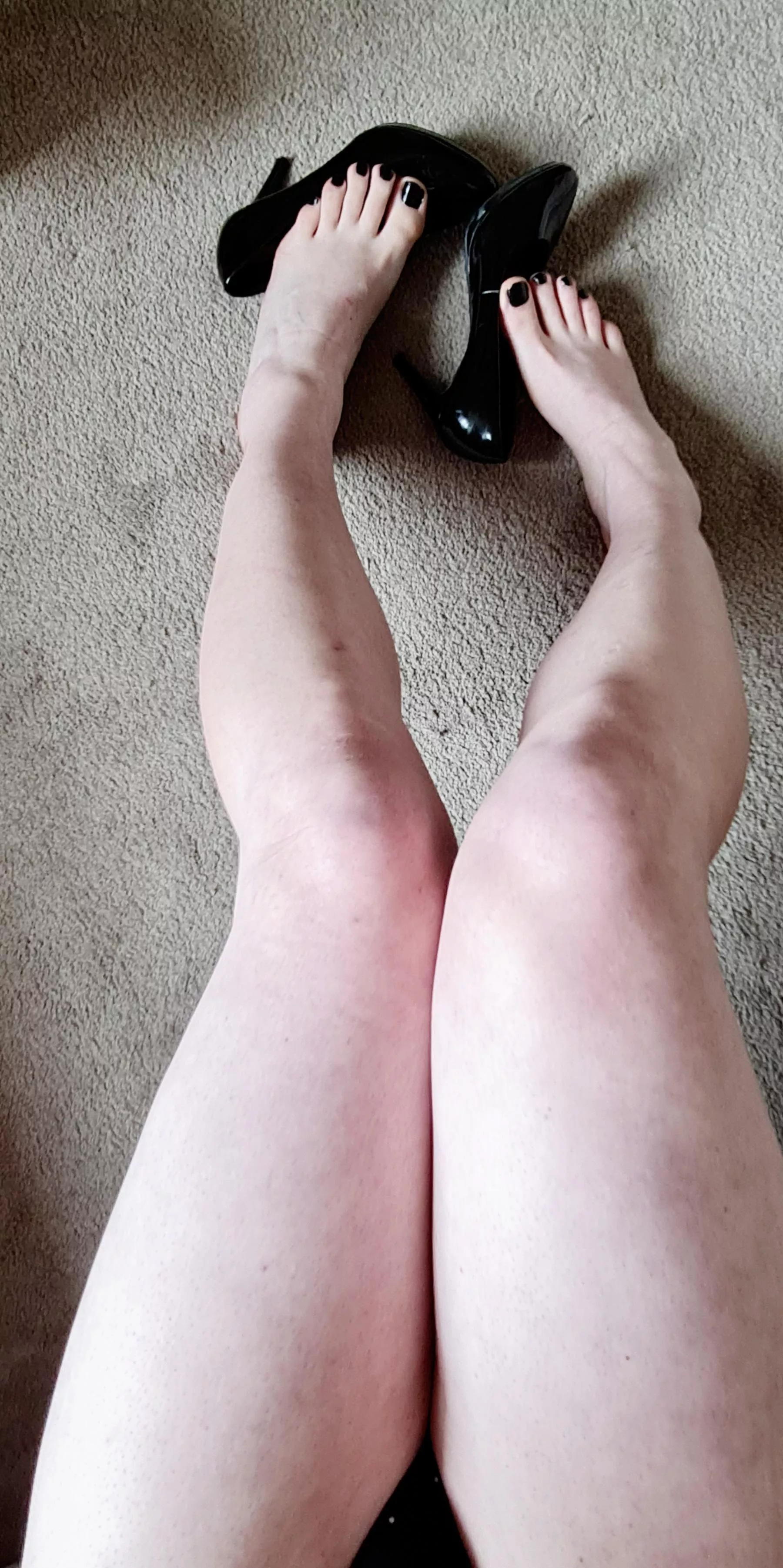 Heels and soft skin