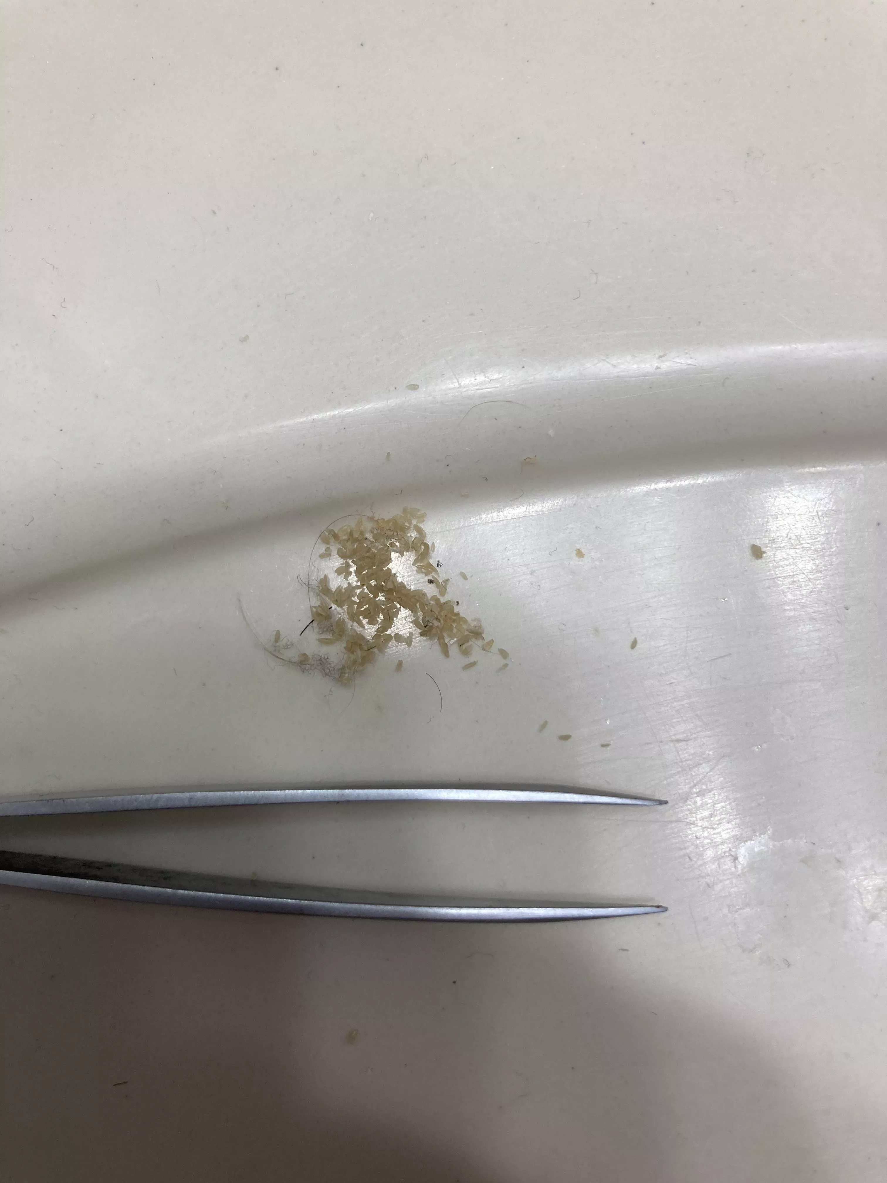 I don’t know what else to do with this picture. All of the blackheads I squeezed out of my nose in about 2 hours.