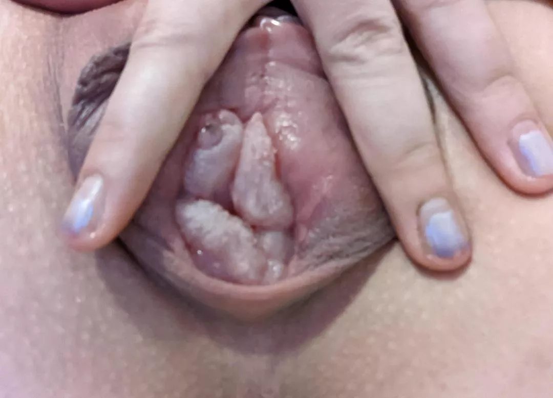 I pumped only the inner this time, I'm in love about how it [f]eels and the prolapsed like look😍🤤