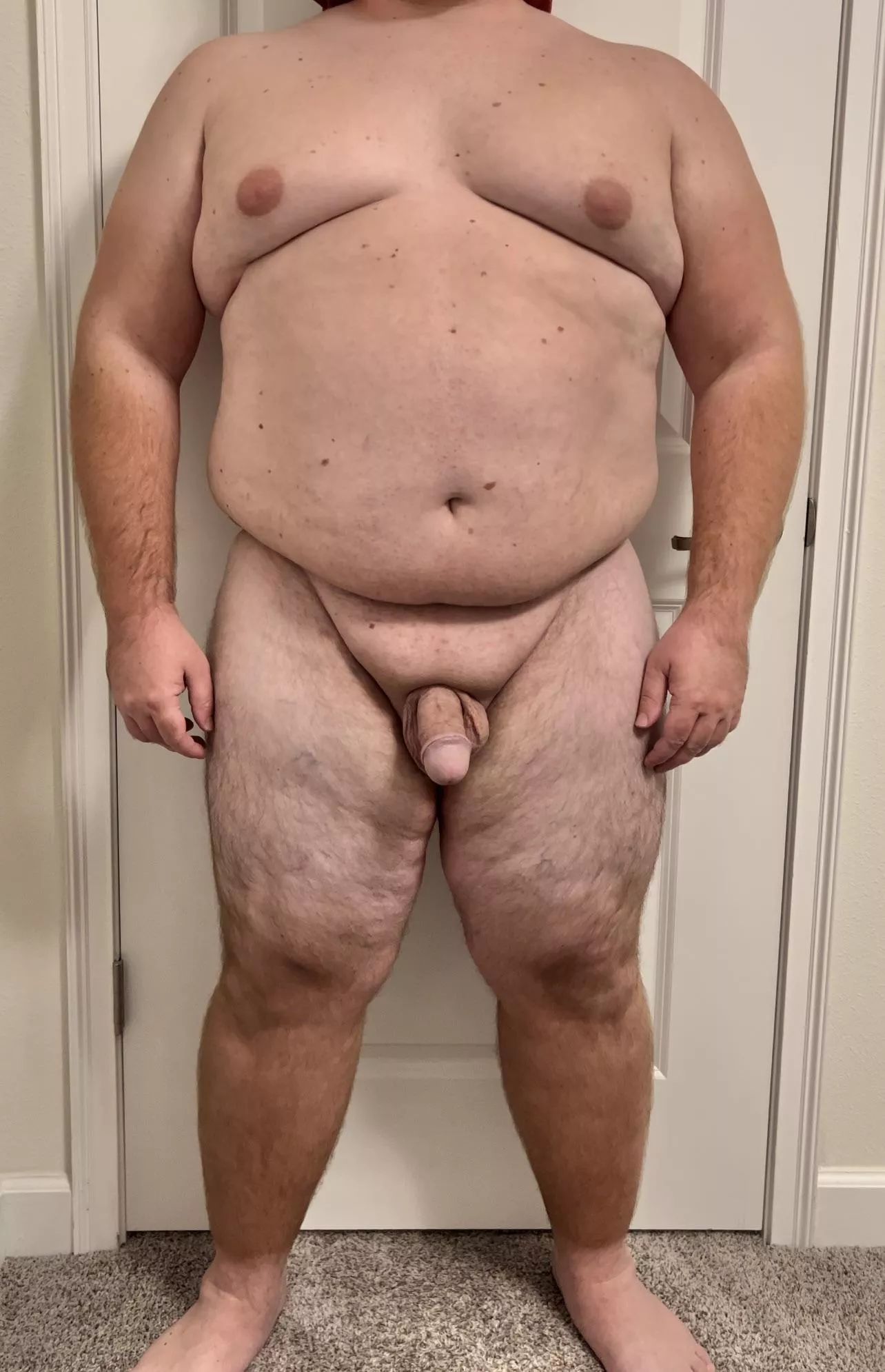Please give honest and critical opinions about my body. I started losing weight and want to push myself to reach my desired weight this year. (M)