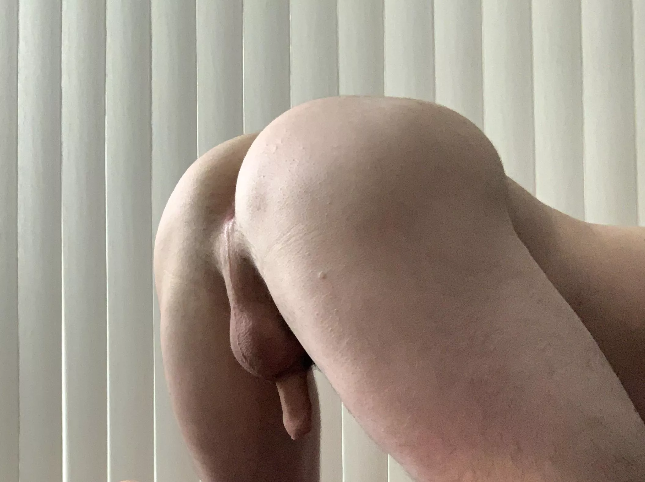 You can see a seam run from my anus, down my scrotum, and then all the way through to the tip of my foreskin. Crazy.