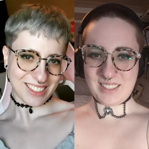 Facial weight gain anyone?