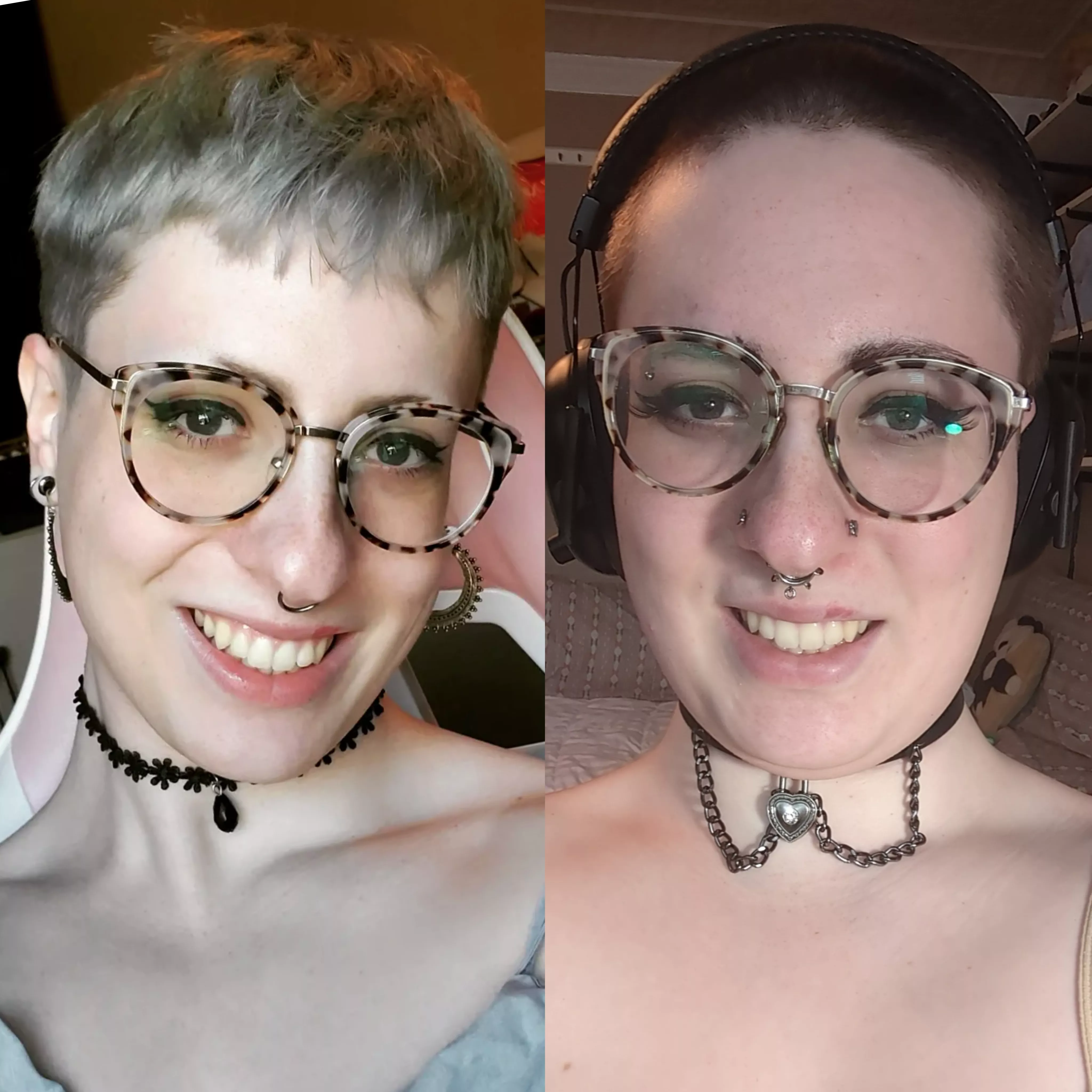 Facial weight gain anyone?