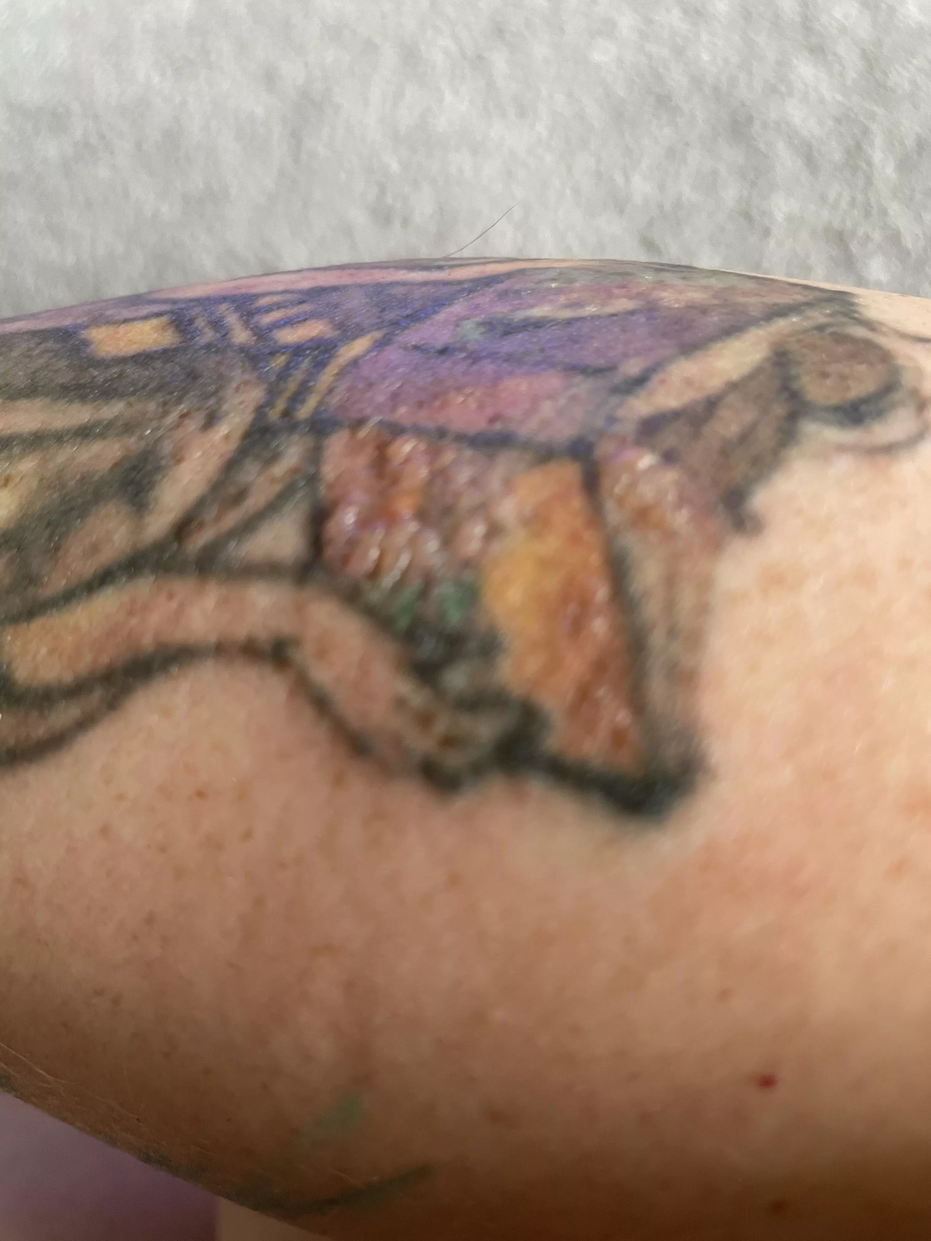 I’m getting a tattoo removed and had a treatment yesterday. Left some nice forbidden pops on the colored sections today.