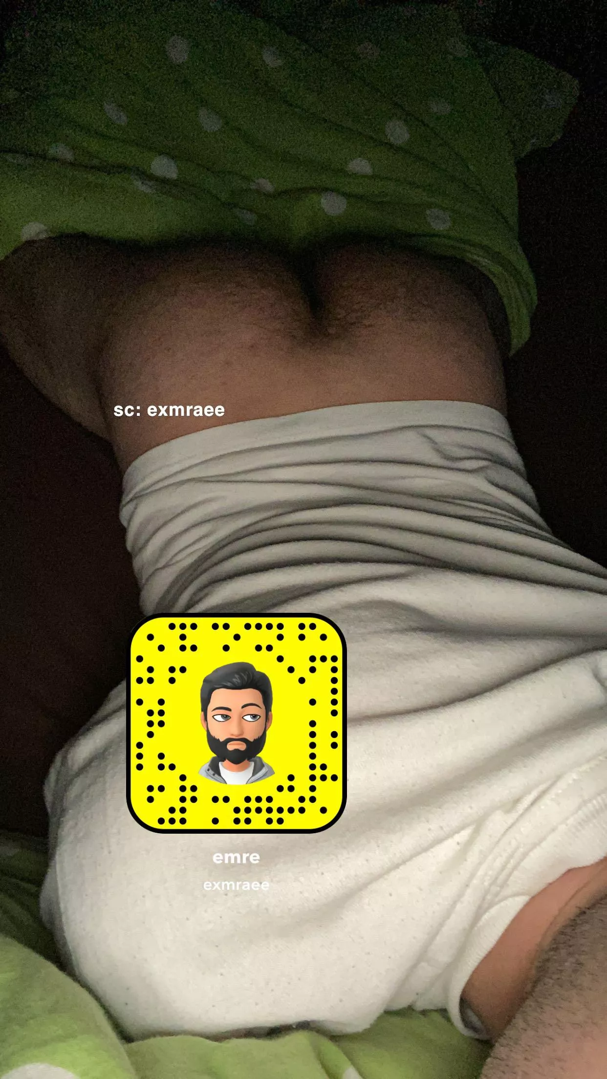 20 Germany, what you think?