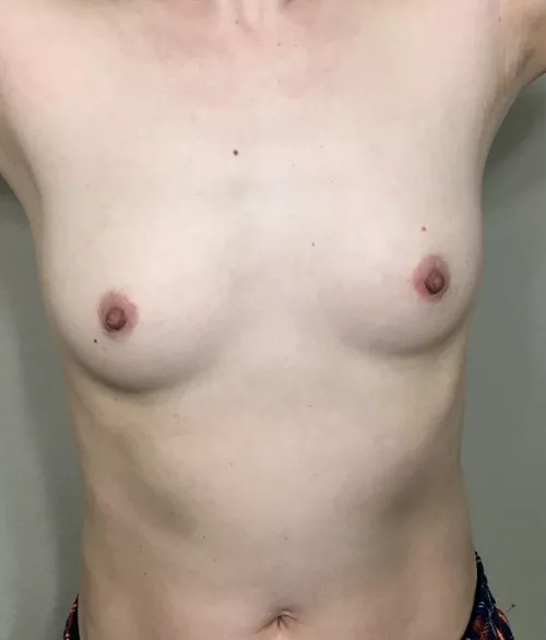35F/120lbs/5”2’ First time posting my small Asian tits