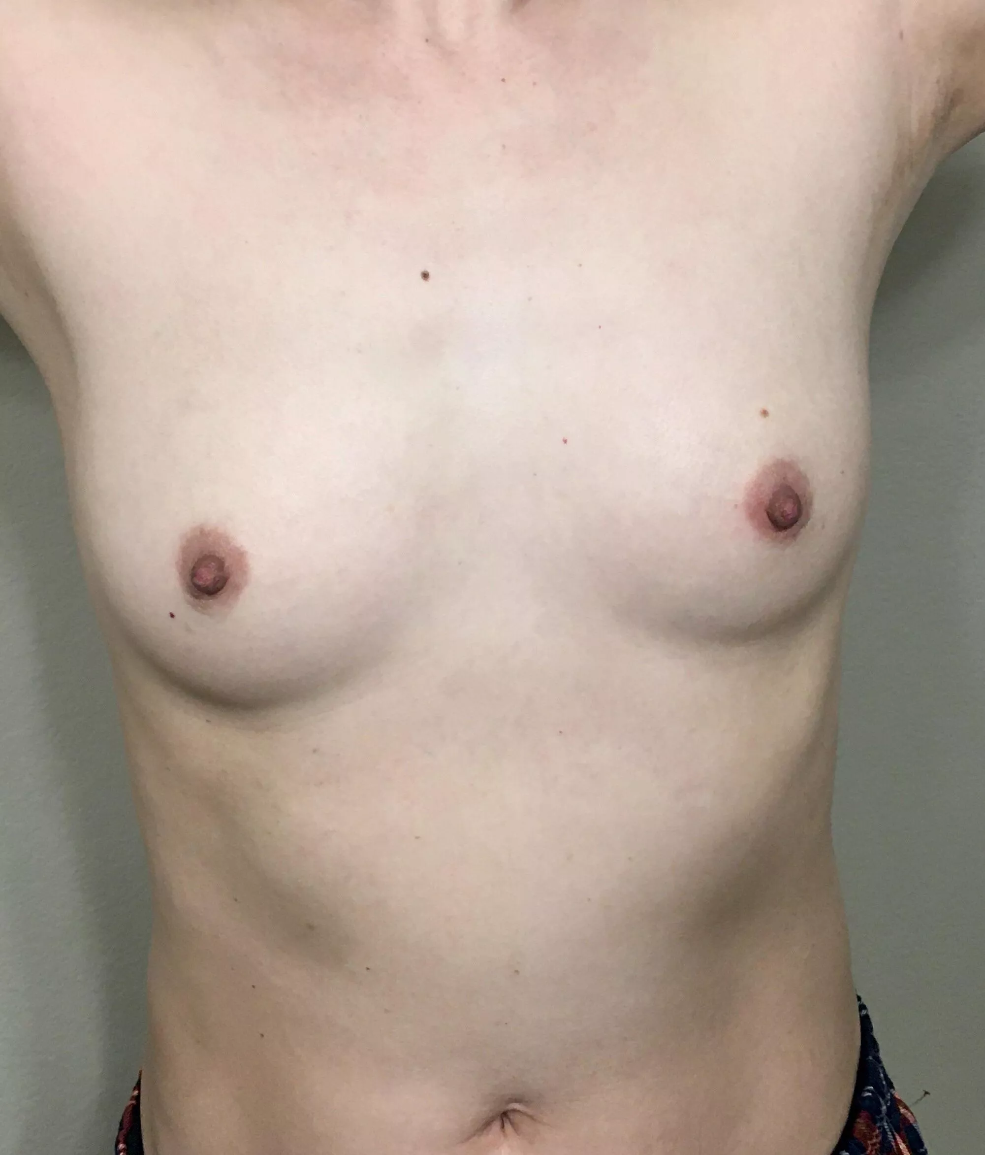 35F/120lbs/5”2’ First time posting my small Asian tits