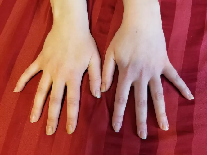 Blank slate, ready for a new manicure. What color would you like to see?