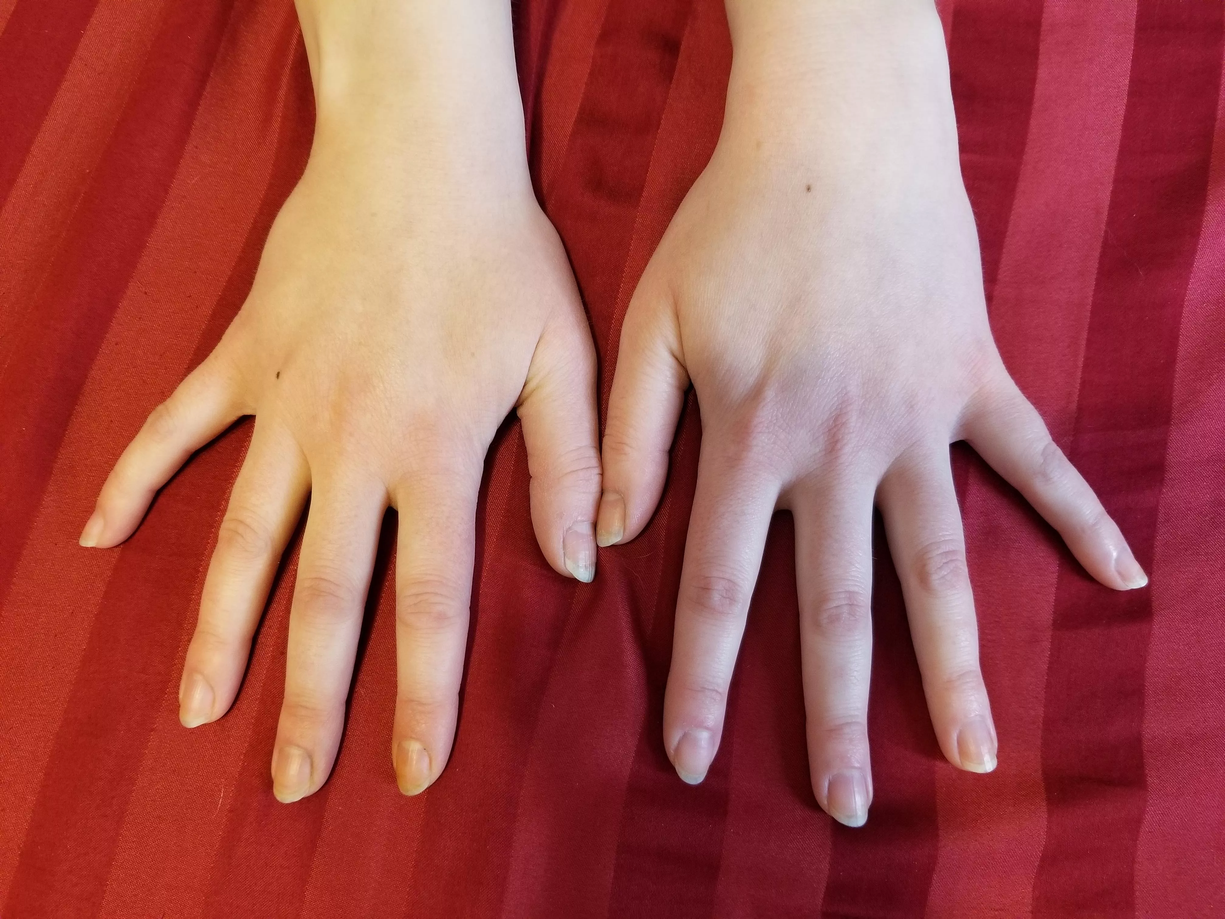 Blank slate, ready for a new manicure. What color would you like to see?