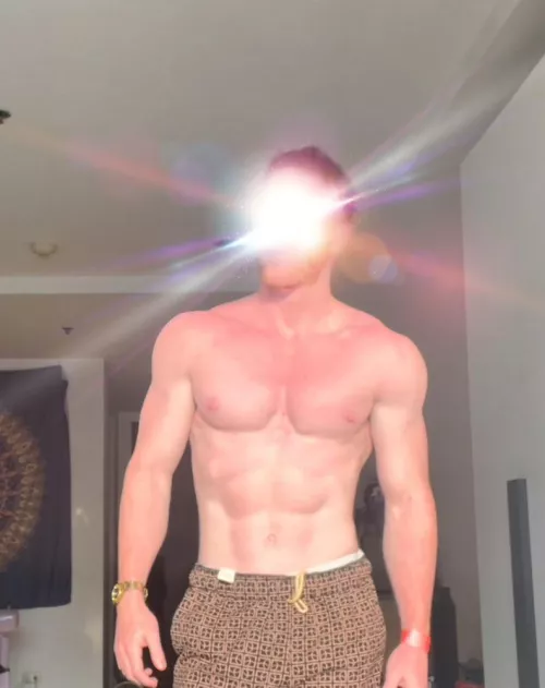 Rub some cream on my burn?