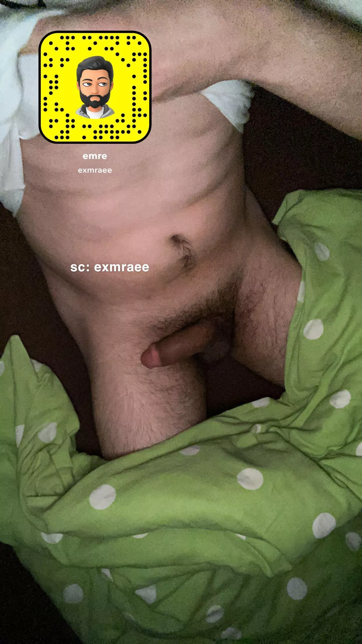 20 Germany, need some help guys