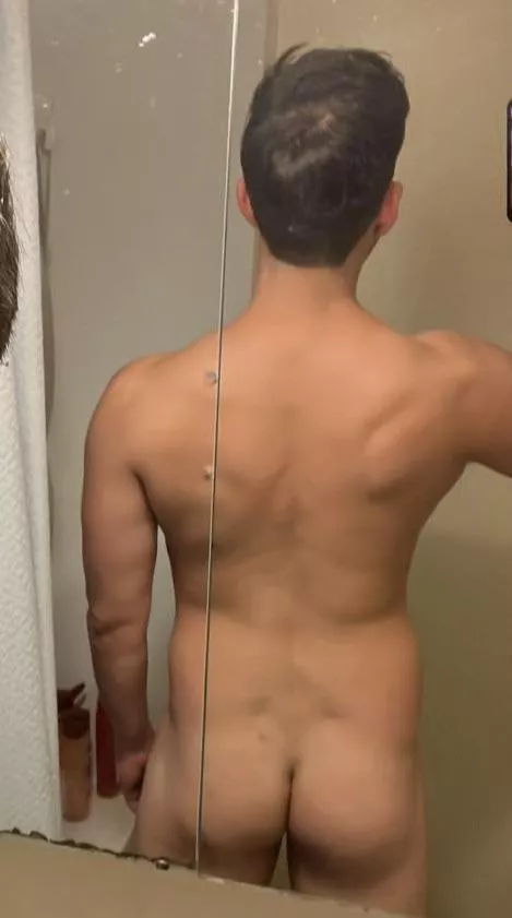 M 34 - rate my back