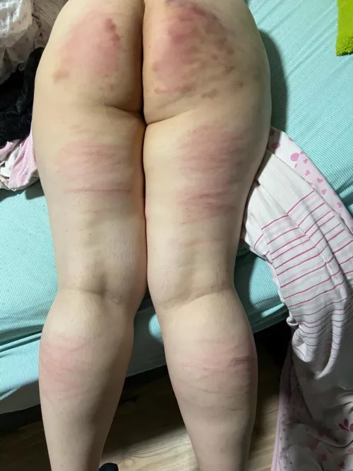 My ugly fat ass got a caning :)