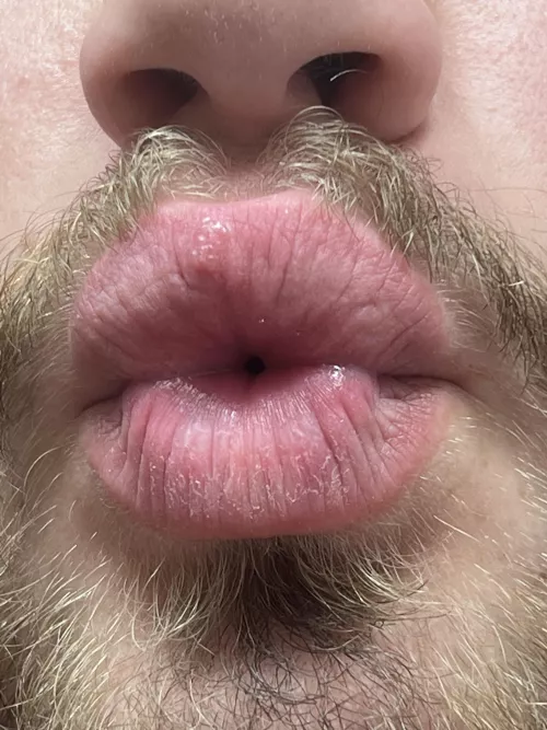 Sorry for the jump scare of a picture but wtf is on my upper lip?