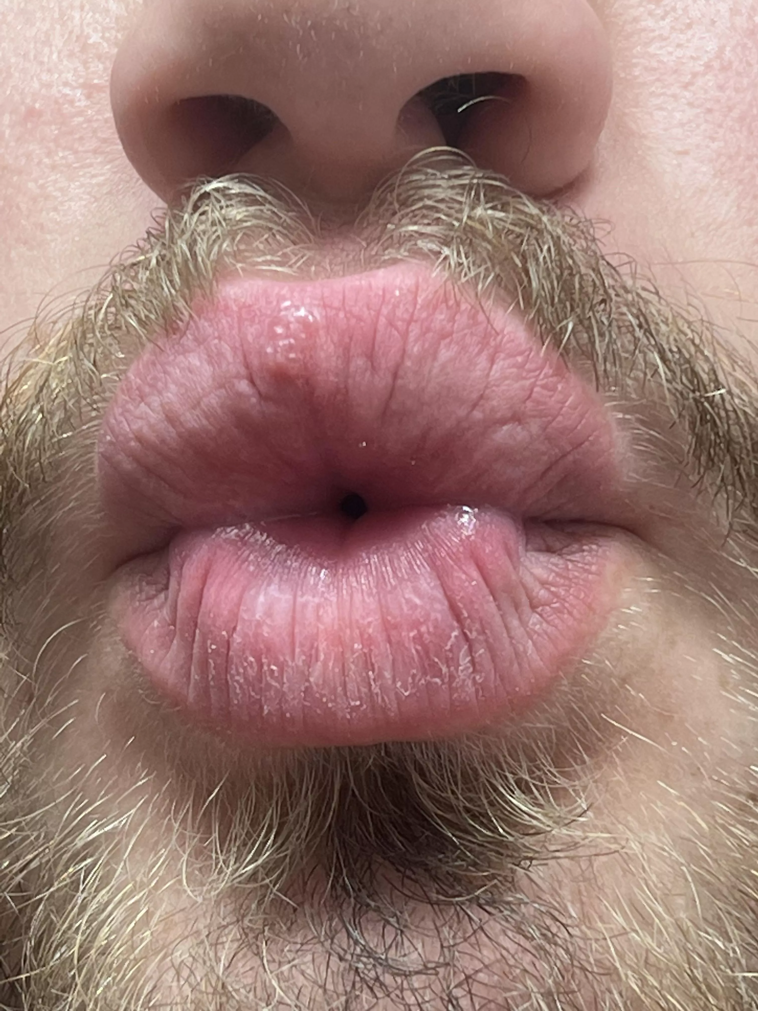 Sorry for the jump scare of a picture but wtf is on my upper lip?