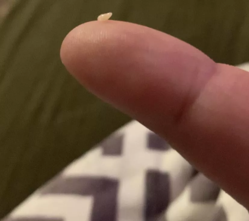 Had this little kernel come out of a pimple today