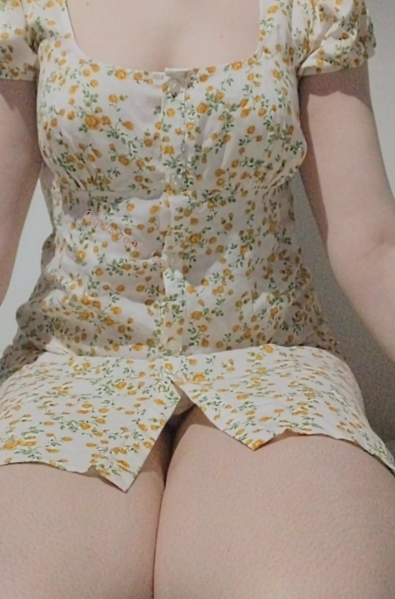 Summer dresses mean easy access 🌼