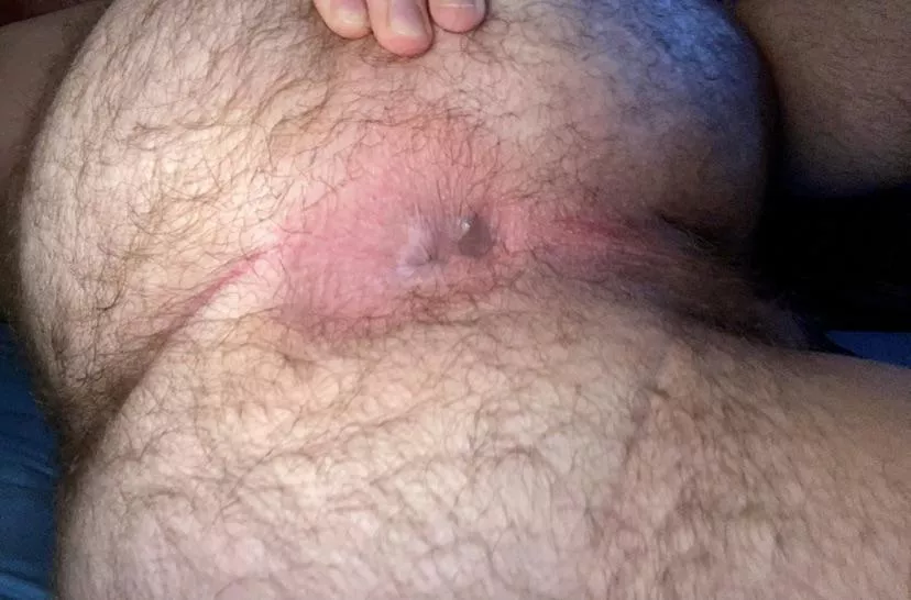 every hole’s a goal, right? (20)