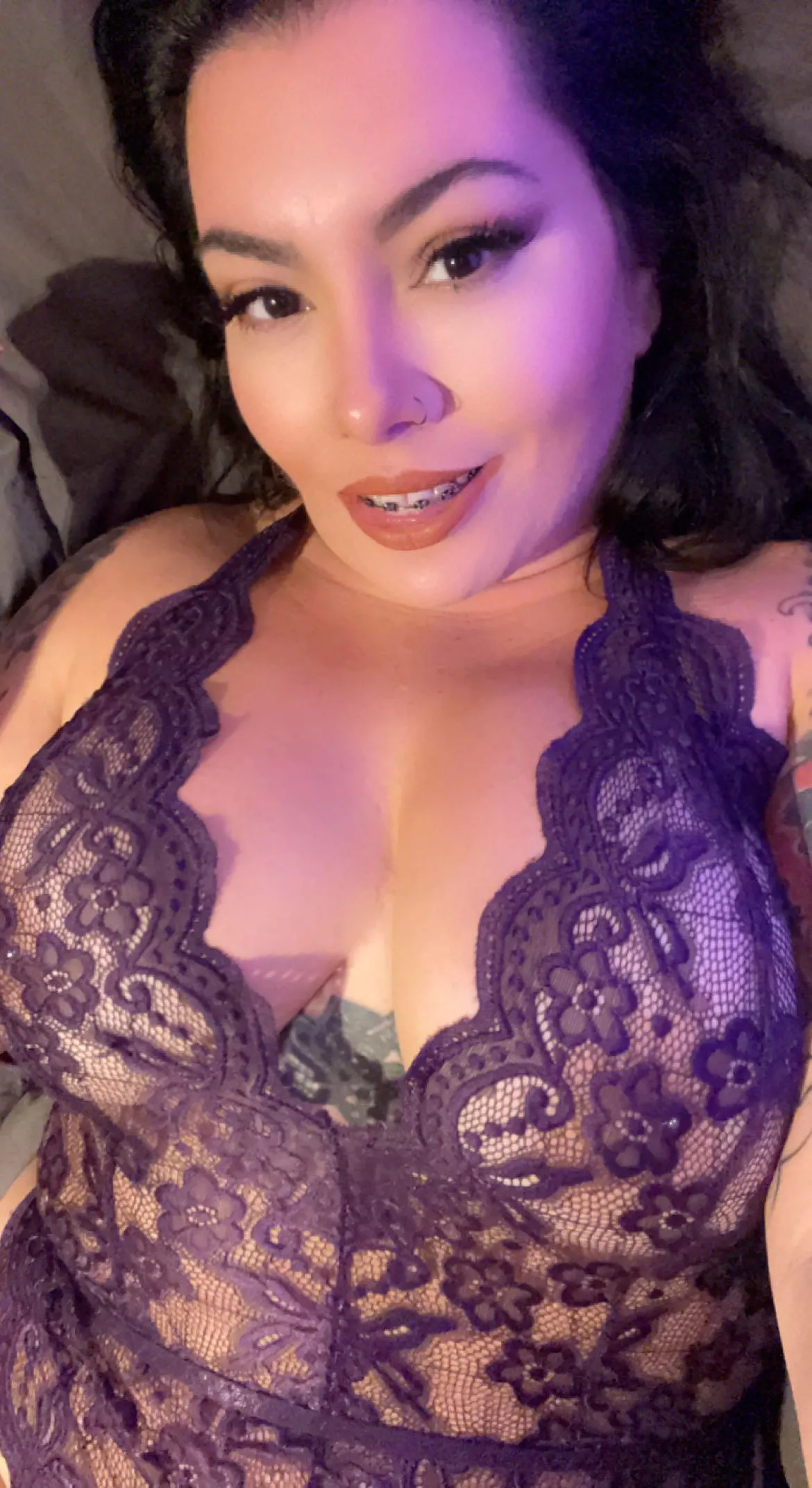 Hope you don’t mind braces