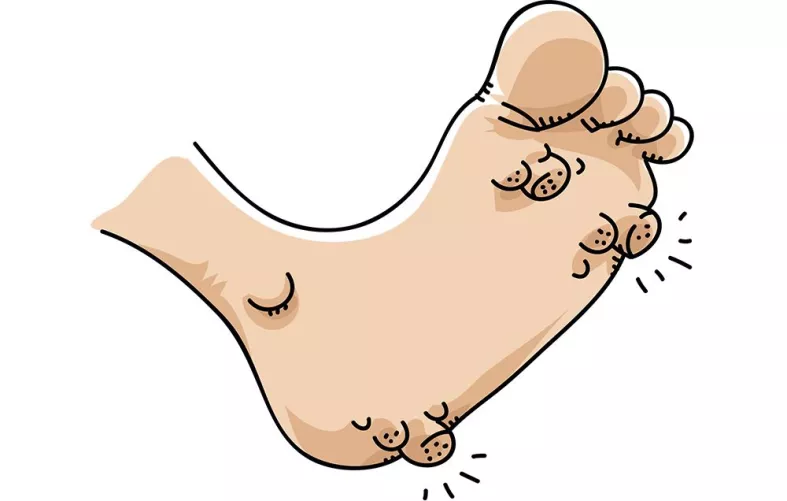 I'm looking for the video with warts being removed from a heel - tape gets peeled off and the warts come with it and its suuuuper satisfying?! I'm sure I saw it here!