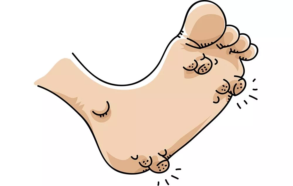 I'm looking for the video with warts being removed from a heel - tape gets peeled off and the warts come with it and its suuuuper satisfying?! I'm sure I saw it here!