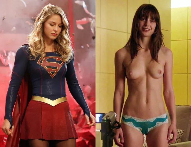 Melissa Benoist on/off
