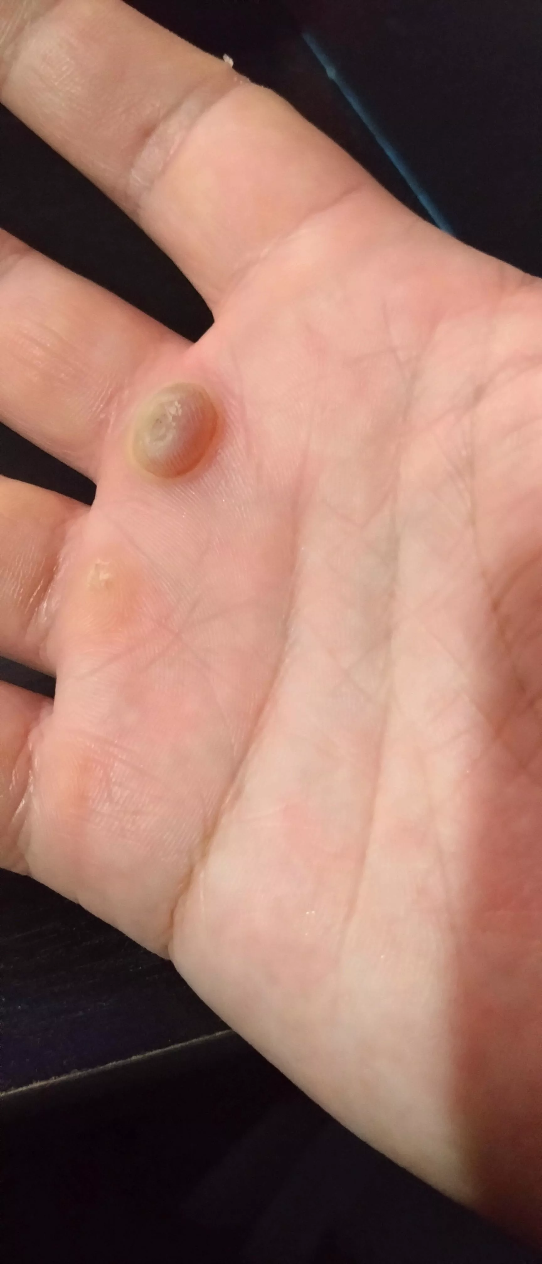 Taking all my willpower not to pop this little fucker