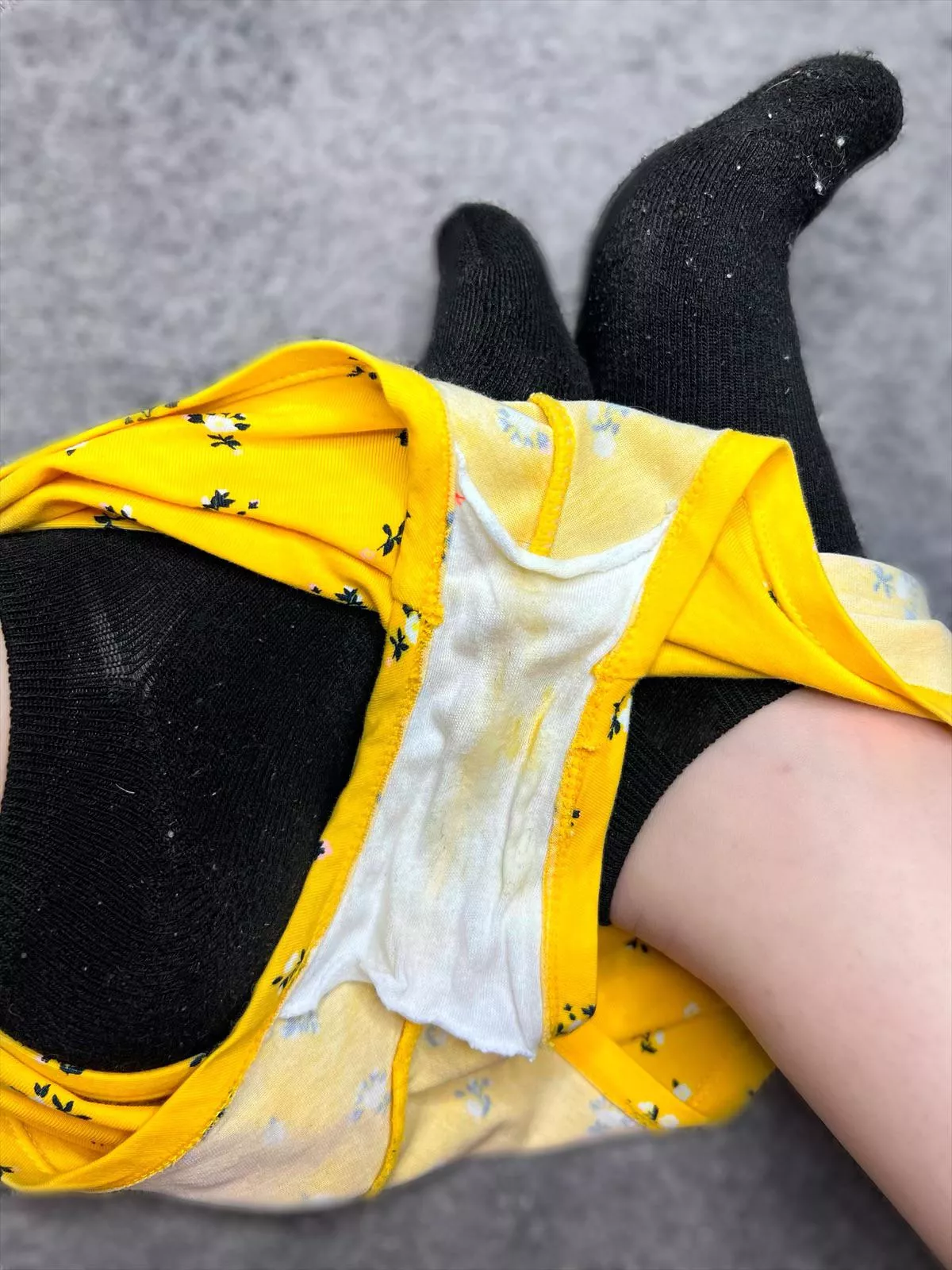 When the color of your grool matches your vibrant yellow cotton boy short panties…I must not have wiped thoroughly, oops!